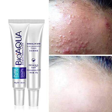 Bioaqua Pure Skin Acne Cream price bd