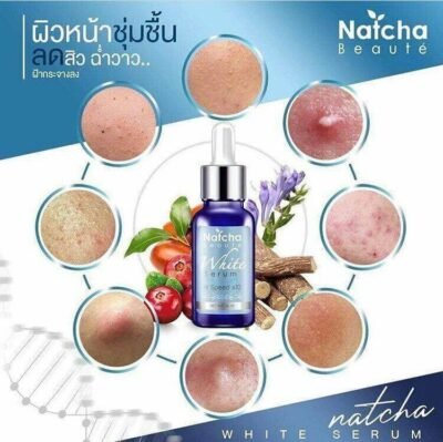 NATCHA SERUM IN BD