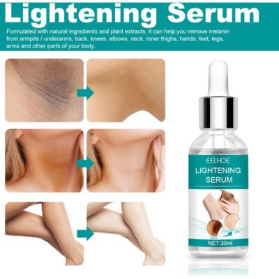 EELHOE Makes Brighter To Your Body And Posture Without Any Side Effect